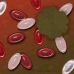 A depiction of cancer with blood cells within the body.